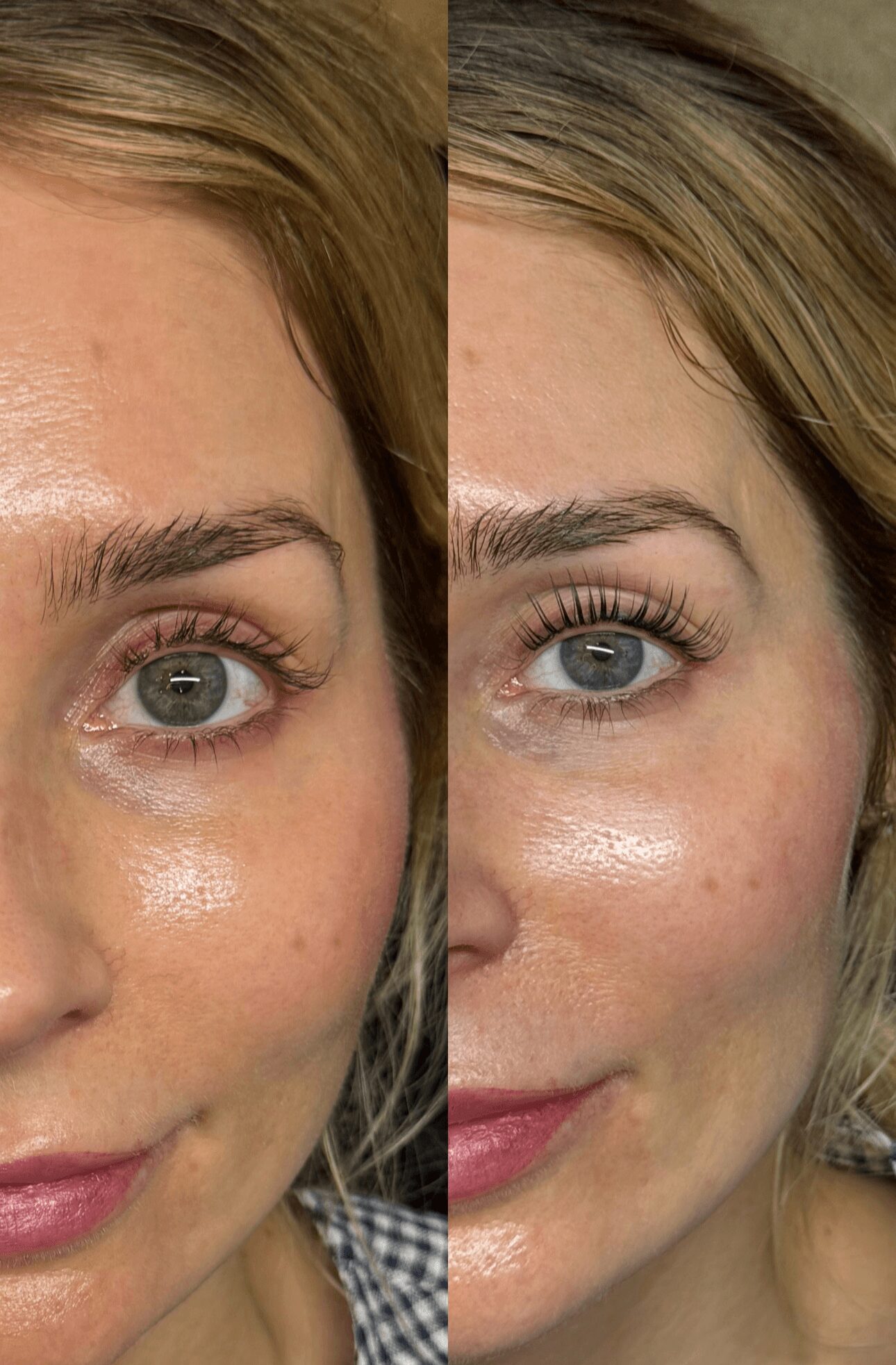 Close-up of a woman's face showing before and after skin improvement, focusing on eye area and cheek.