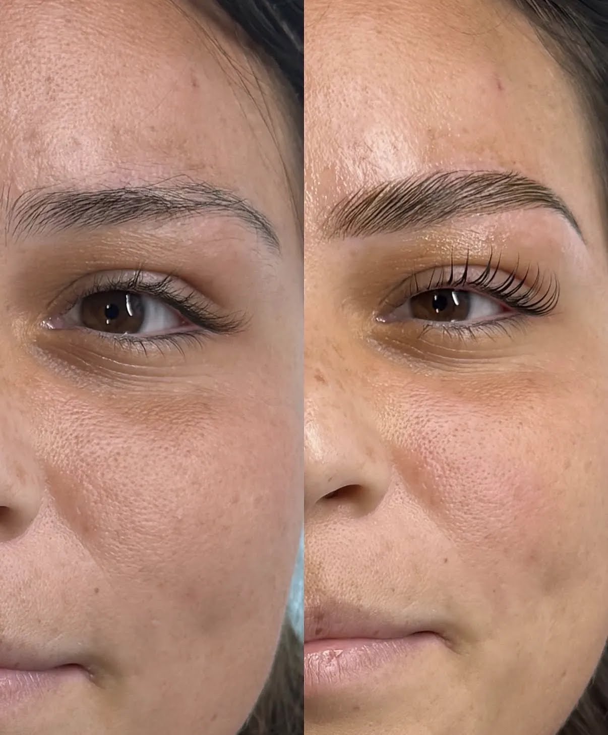 Side-by-side comparison of a woman's face showing improved skin and well-groomed eyebrows after treatment.