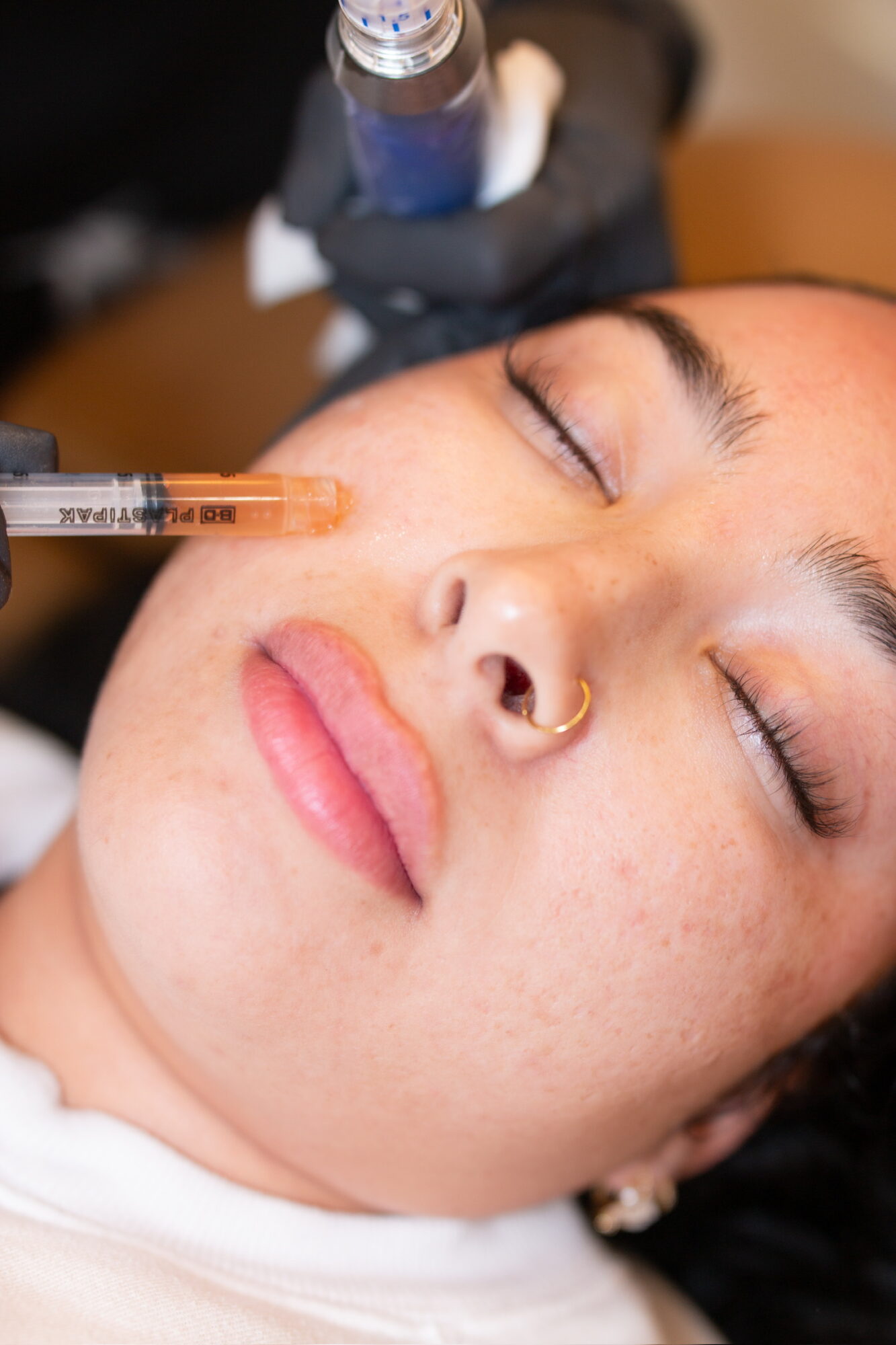 Person receiving a cosmetic injection near the nose while lying down with eyes closed, with a gloved hand holding a syringe.