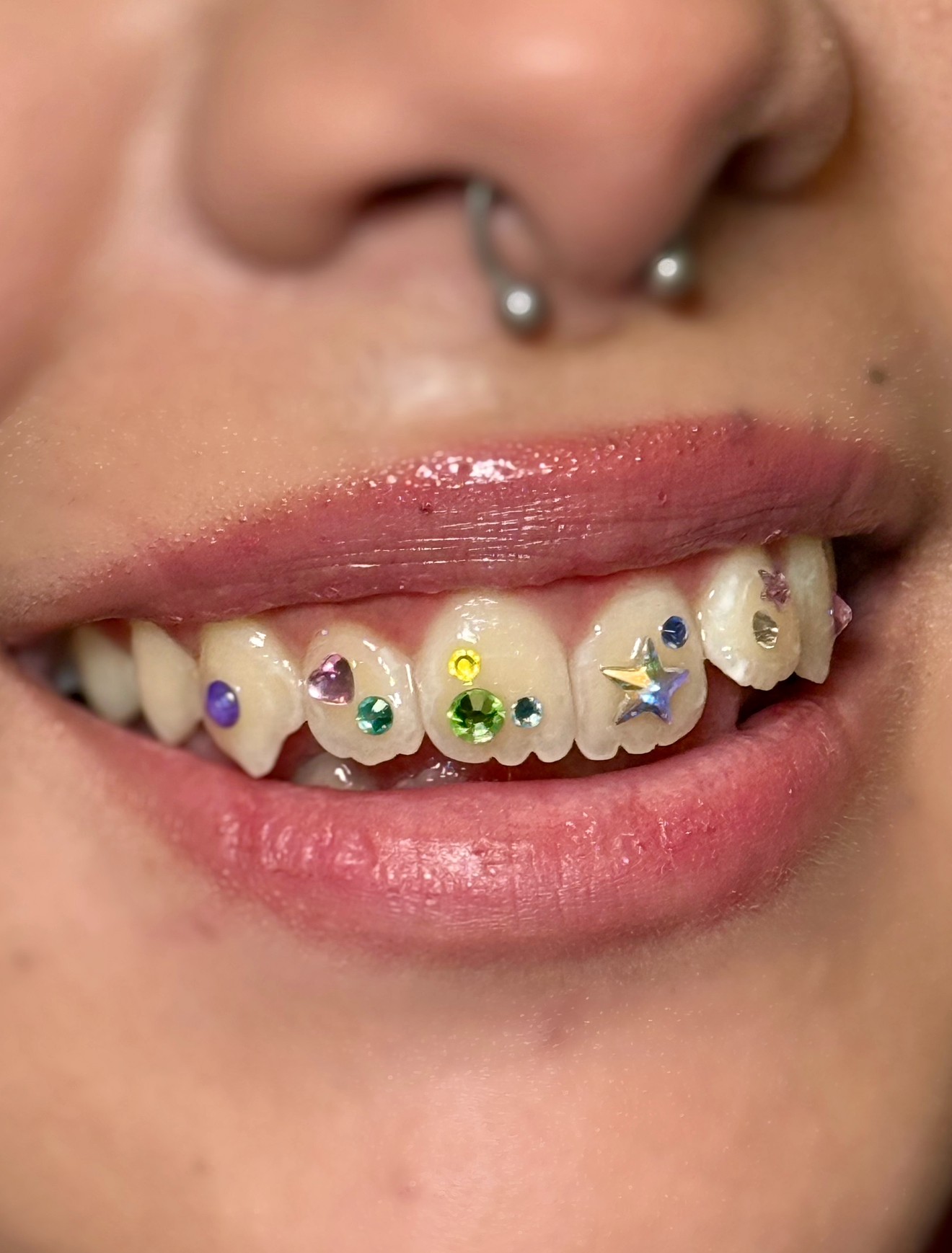 Close-up of a person's mouth with decorated teeth and a septum piercing.