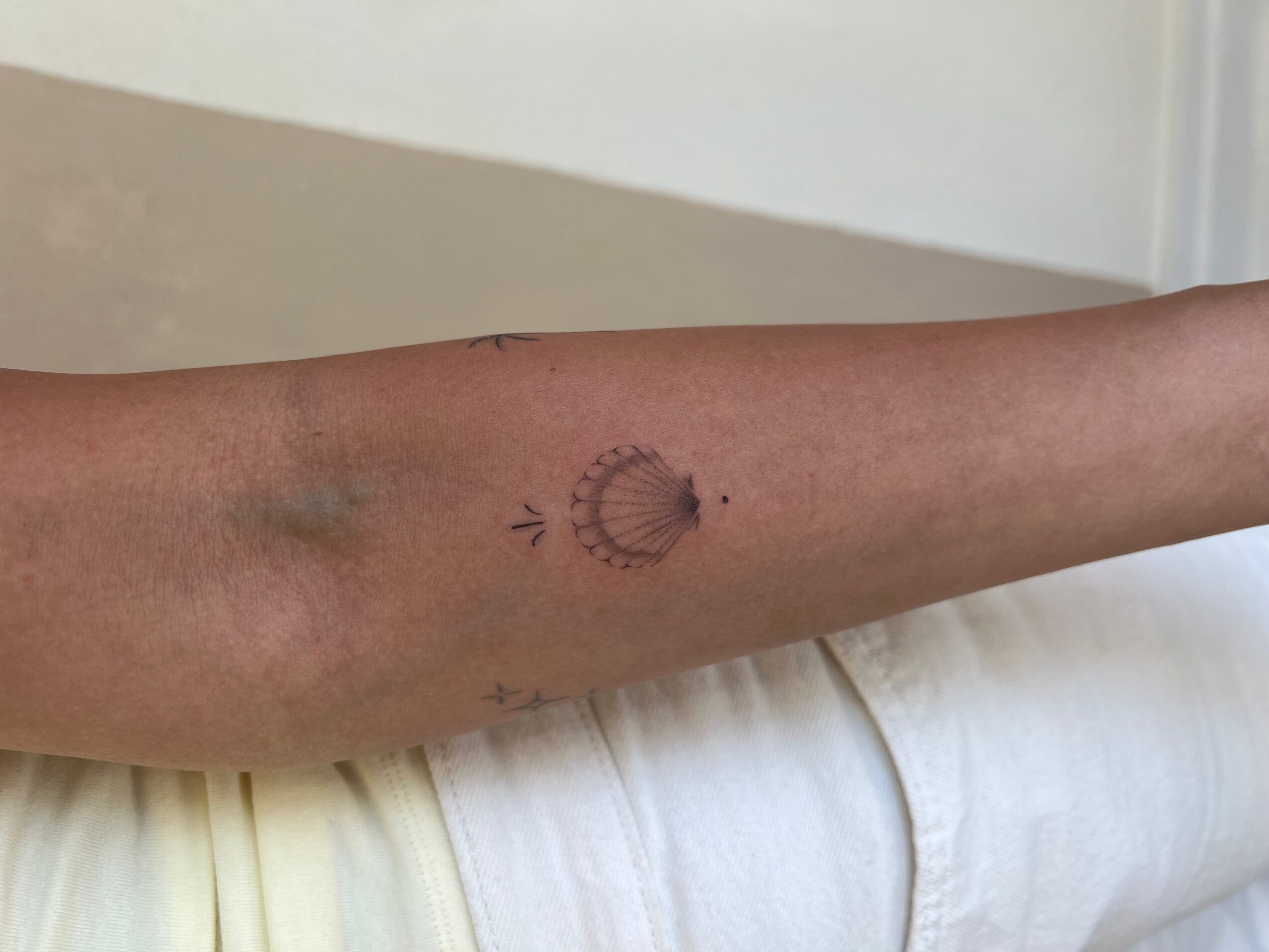 Forearm with a small circular tattoo and a faint bruise, resting on a white surface.
