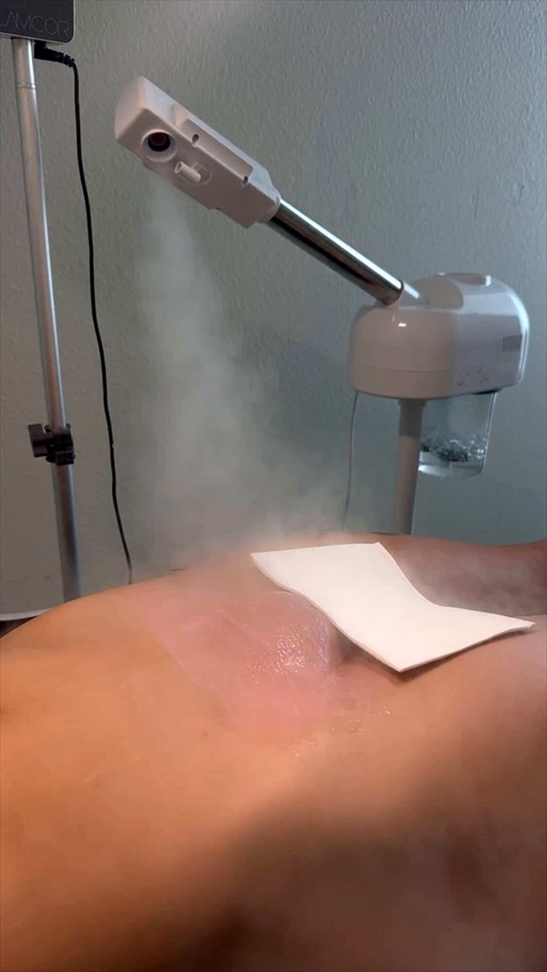 Medical device positioned above a patient's abdomen with a paper towel nearby, against a light-colored wall.